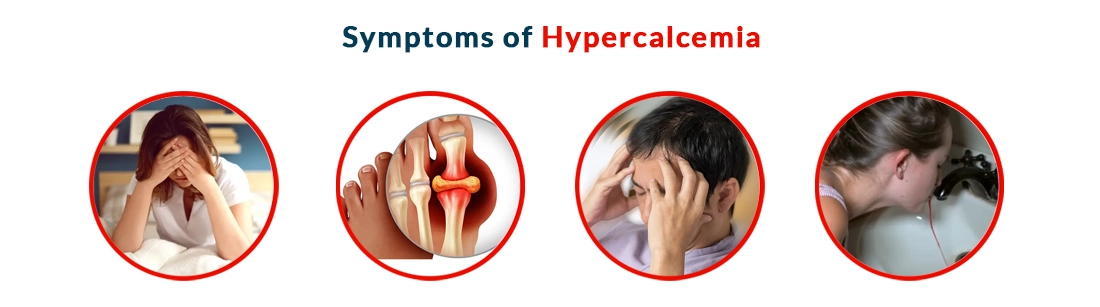 Symptoms of Hypercalcemia